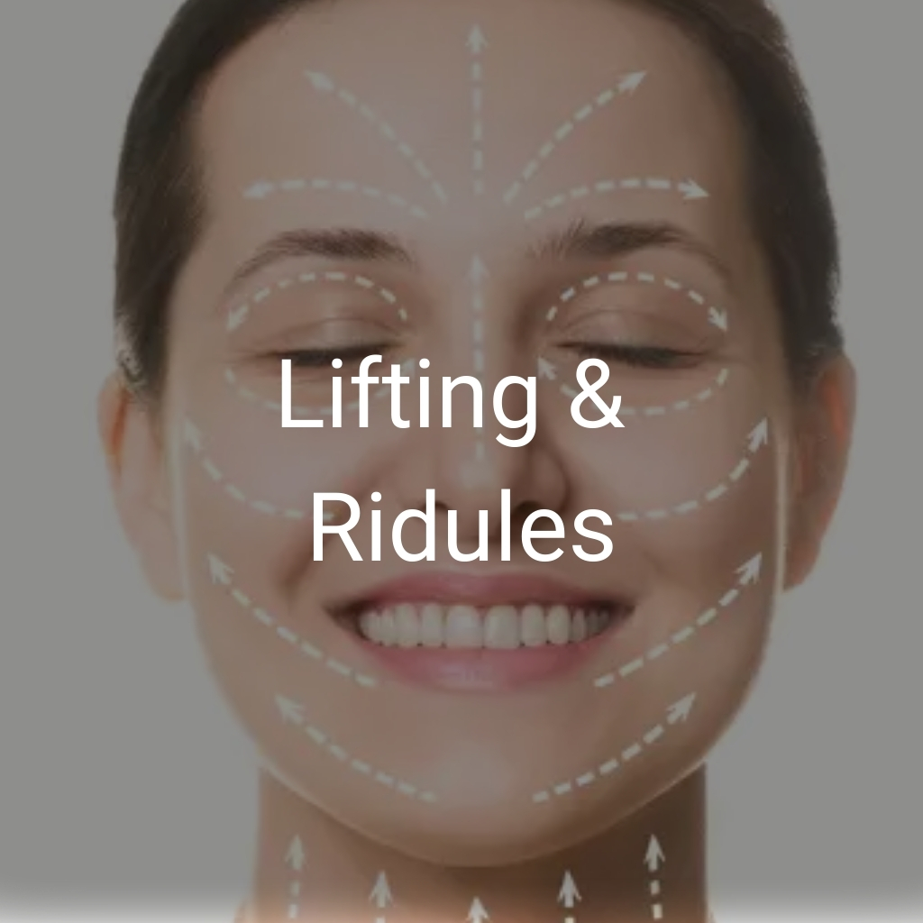 Lifting et Ridules
