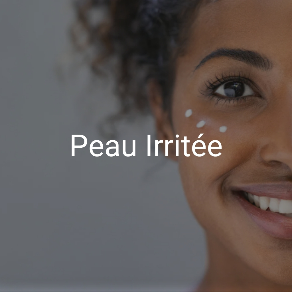 Peau irritée